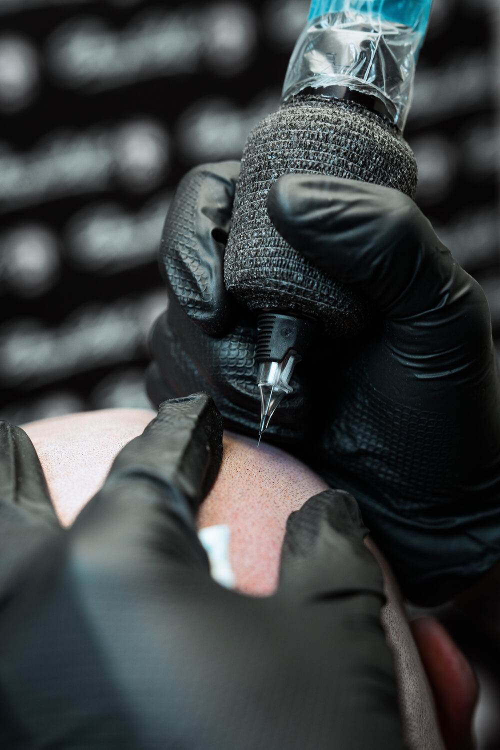 Close-up of Sharp SMP scalp micropigmentation being applied with fine needles
